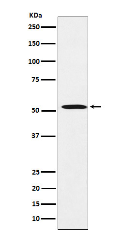 1 - Anti-FADS1 Rabbit Monoclonal Antibody ABO16076