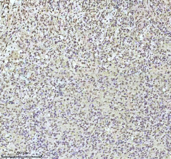 2 - Anti-QK1 Rabbit Monoclonal Antibody ABO16077