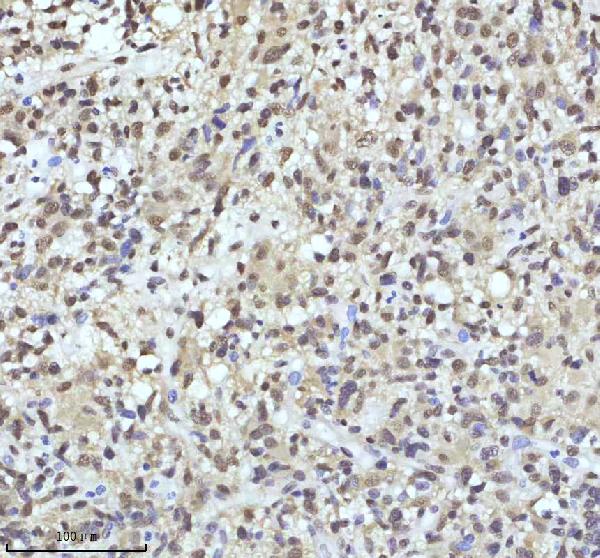 2 - Anti-QK1 Rabbit Monoclonal Antibody ABO16077