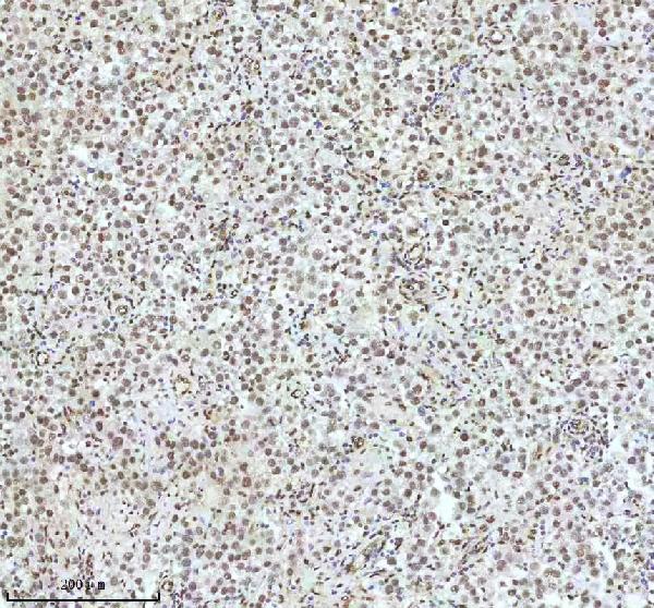 2 - Anti-QK1 Rabbit Monoclonal Antibody ABO16077