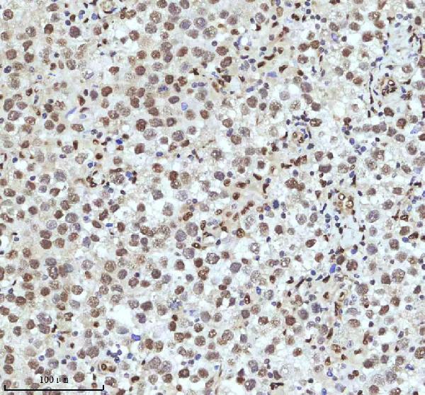 2 - Anti-QK1 Rabbit Monoclonal Antibody ABO16077