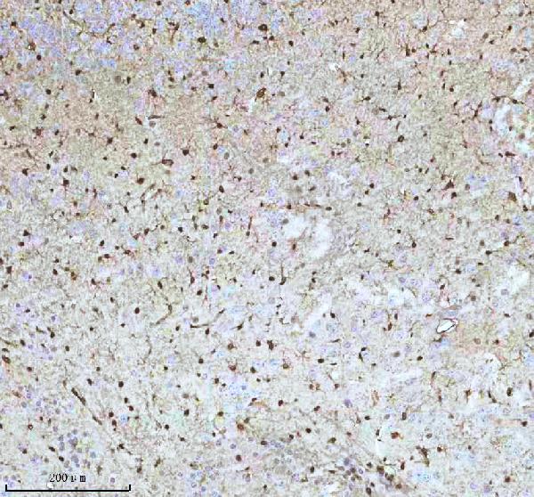 2 - Anti-QK1 Rabbit Monoclonal Antibody ABO16077
