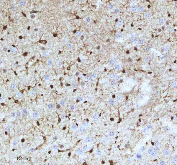2 - Anti-QK1 Rabbit Monoclonal Antibody ABO16077