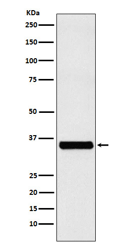 1 - Anti-EXOSC7 Rabbit Monoclonal Antibody ABO16078