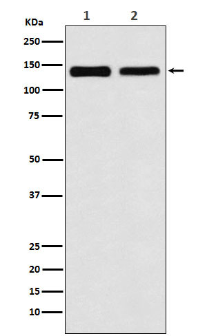 1 - Anti-UBE4B Rabbit Monoclonal Antibody ABO16080