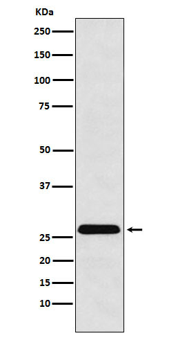 1 - Anti-HLA-DRB4 Rabbit Monoclonal Antibody ABO16082