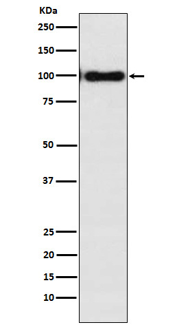1 - Anti-Desmocollin-3 Rabbit Monoclonal Antibody ABO16083