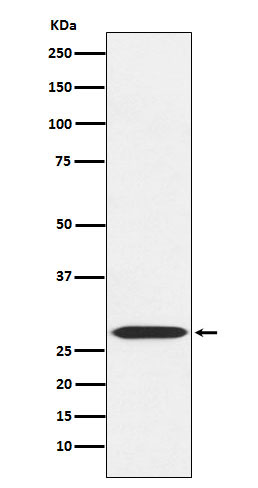 1 - Anti-MRPL28 Rabbit Monoclonal Antibody ABO16084