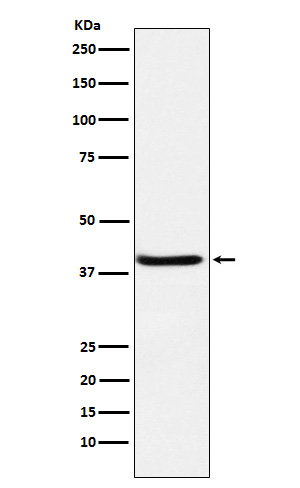 1 - Anti-SerpinB3 Rabbit Monoclonal Antibody ABO16085