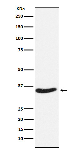 1 - Anti-EXOSC7 Rabbit Monoclonal Antibody ABO16088