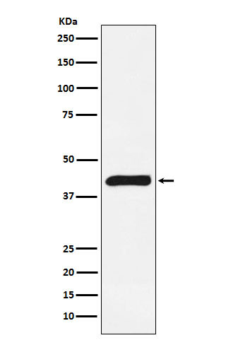 1 - Anti-ALKBH1 Rabbit Monoclonal Antibody ABO16089