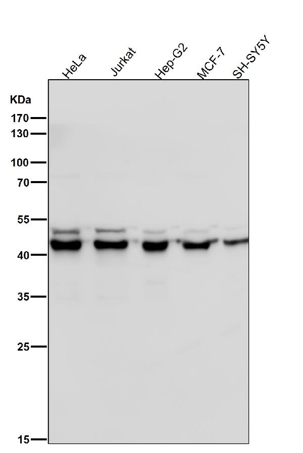 1 - Anti-ALKBH1 Rabbit Monoclonal Antibody ABO16089