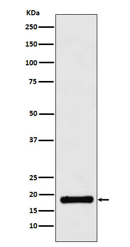 1 - Anti-UBE2B Rabbit Monoclonal Antibody ABO16090