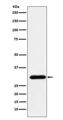 1 - Anti-GTF2F2 Rabbit Monoclonal Antibody ABO16091