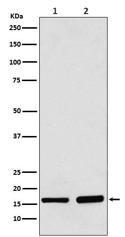 1 - Anti-AP2S1 Rabbit Monoclonal Antibody ABO16092