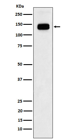 1 - Anti-GTF2I Rabbit Monoclonal Antibody ABO16093