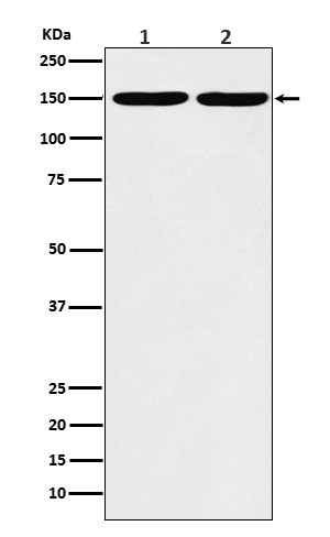 1 - Anti-Collagen III Rabbit Monoclonal Antibody ABO16095