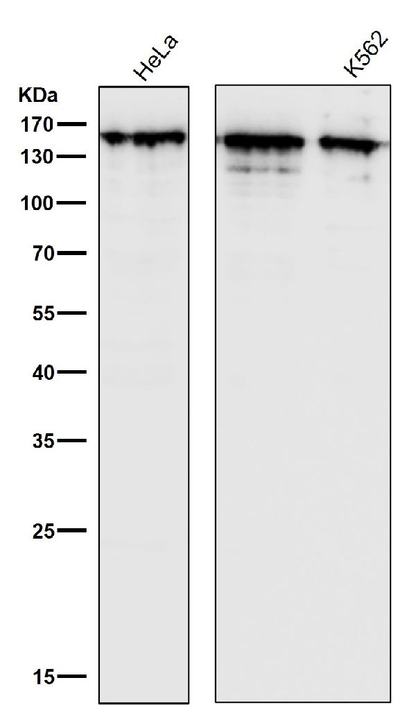 1 - Anti-Collagen III Rabbit Monoclonal Antibody ABO16095