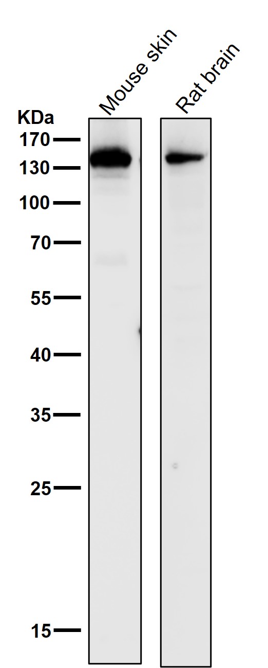 1 - Anti-Collagen III Rabbit Monoclonal Antibody ABO16095