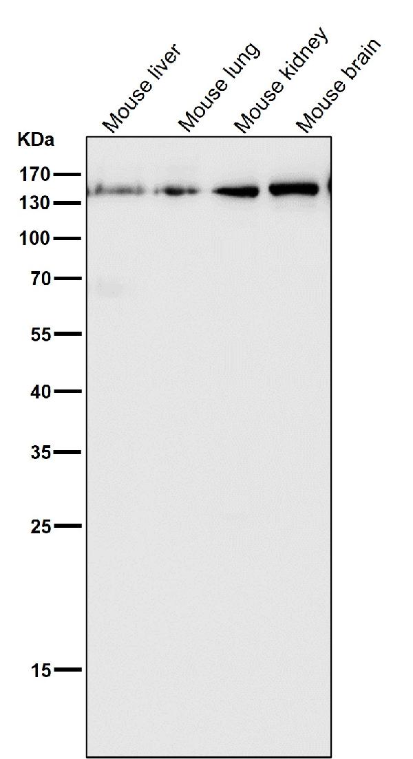 1 - Anti-Collagen III Rabbit Monoclonal Antibody ABO16095