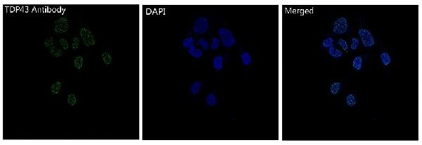 3 - Anti-TDP43 Rabbit Monoclonal Antibody ABO16096