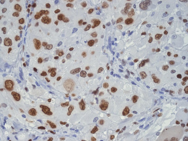 2 - Anti-TDP43 Rabbit Monoclonal Antibody ABO16096