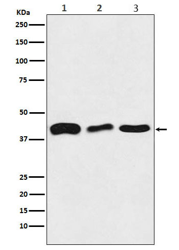1 - Anti-TDP43 Rabbit Monoclonal Antibody ABO16096