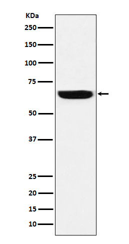 1 - Anti-GBP1 Rabbit Monoclonal Antibody ABO16098