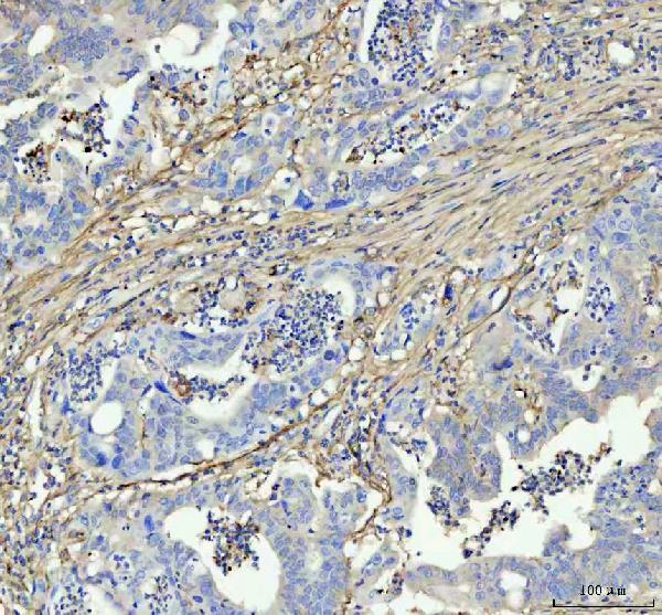 2 - Anti-Fibronectin Rabbit Monoclonal Antibody ABO16099