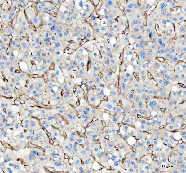 2 - Anti-Fibronectin Rabbit Monoclonal Antibody ABO16099