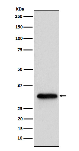 1 - Anti-NUDT5 Rabbit Monoclonal Antibody ABO16103