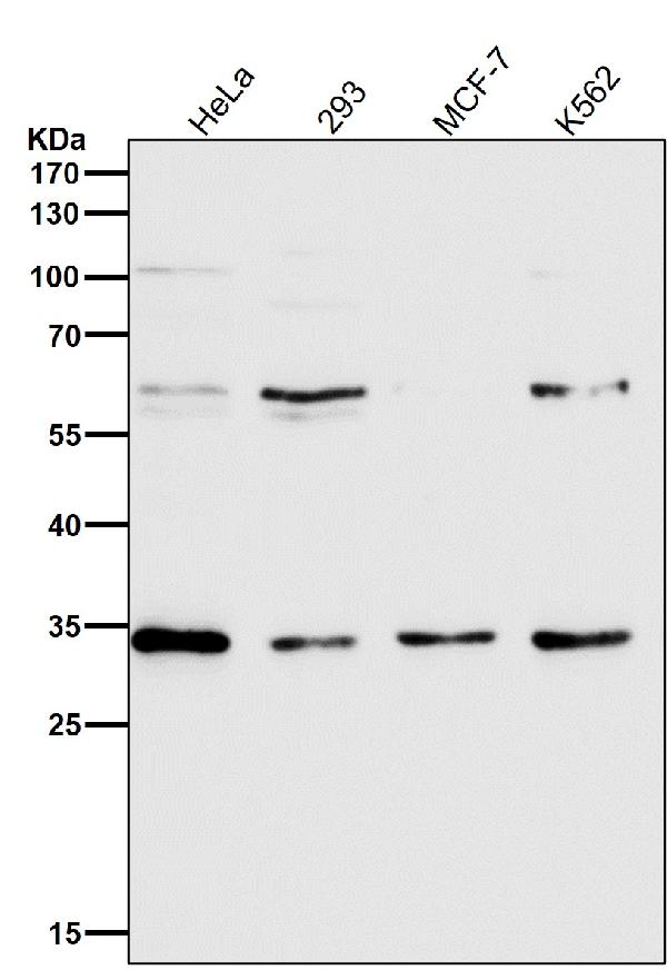 1 - Anti-NUDT5 Rabbit Monoclonal Antibody ABO16103