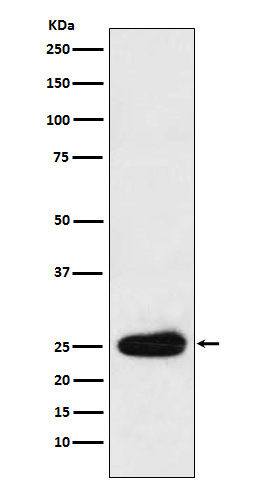 1 - Anti-Kappa light chain Rabbit Monoclonal Antibody ABO16105