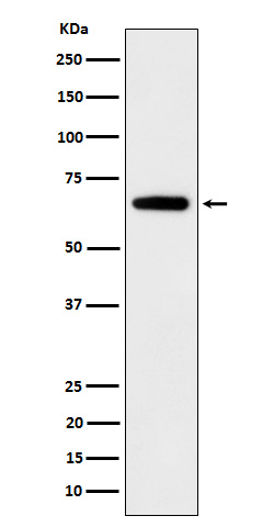 1 - Anti-IGF2BP2 Rabbit Monoclonal Antibody ABO16107