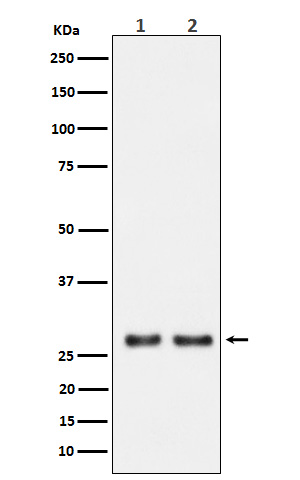 1 - Anti-UPP1 Rabbit Monoclonal Antibody ABO16109