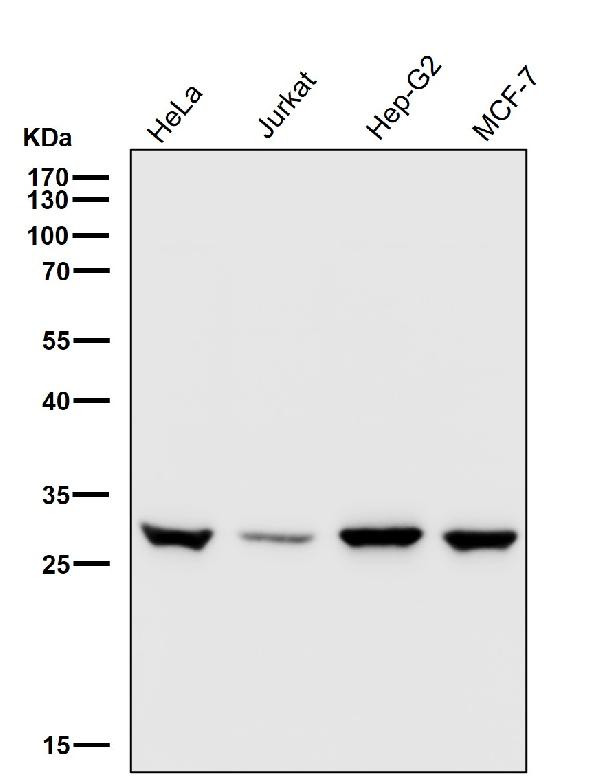 1 - Anti-UPP1 Rabbit Monoclonal Antibody ABO16109