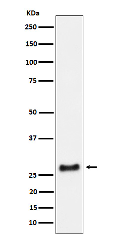 1 - Anti-SNRPA1 Rabbit Monoclonal Antibody ABO16110