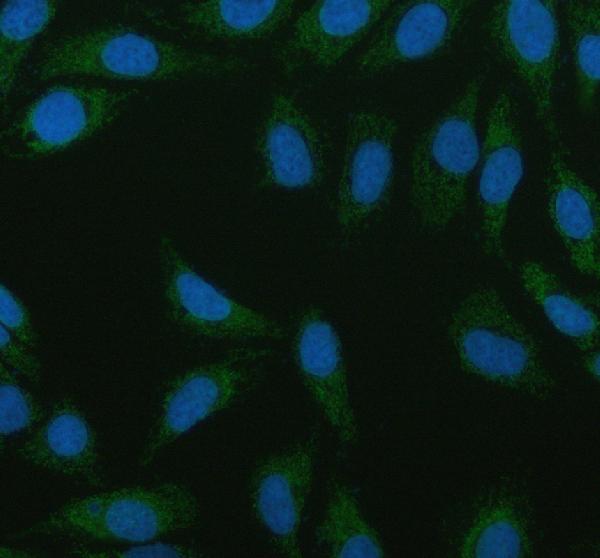 3 - Anti-ACAA2 Rabbit Monoclonal Antibody ABO16111