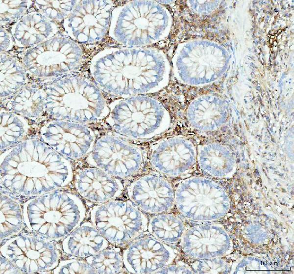 2 - Anti-ACAA2 Rabbit Monoclonal Antibody ABO16111