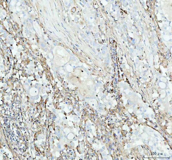 2 - Anti-ACAA2 Rabbit Monoclonal Antibody ABO16111