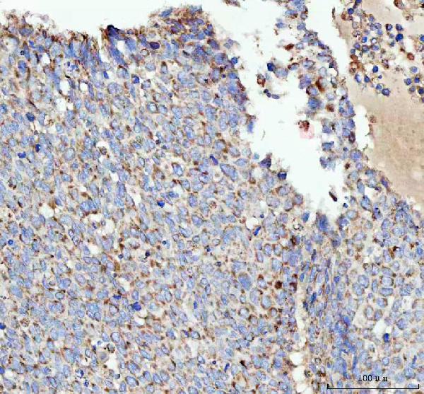 2 - Anti-ACAA2 Rabbit Monoclonal Antibody ABO16111