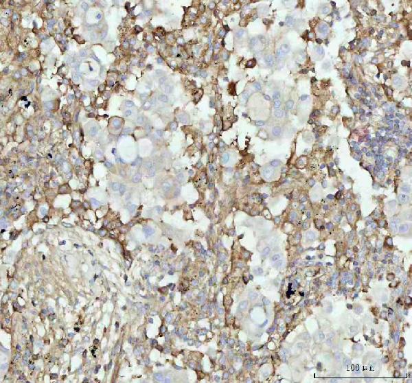2 - Anti-ACAA2 Rabbit Monoclonal Antibody ABO16111