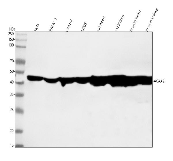 1 - Anti-ACAA2 Rabbit Monoclonal Antibody ABO16111