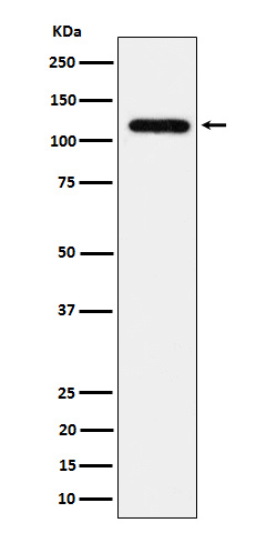 1 - Anti-UBE4A Rabbit Monoclonal Antibody ABO16112