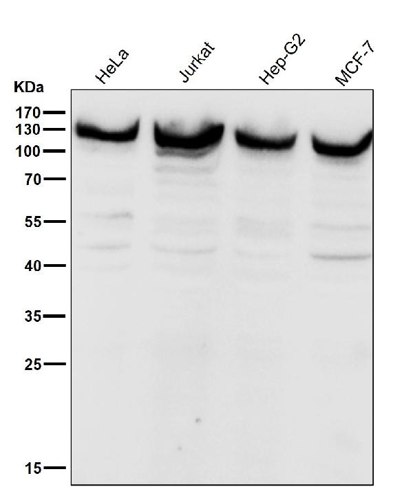 1 - Anti-UBE4A Rabbit Monoclonal Antibody ABO16112