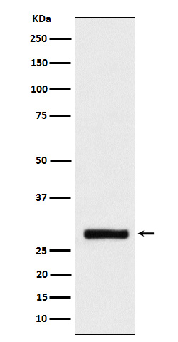 1 - Anti-BRMS1 Rabbit Monoclonal Antibody ABO16114