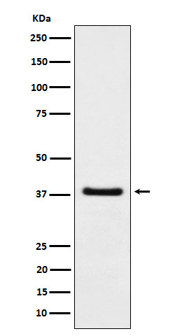 1 - Anti-HDGF Rabbit Monoclonal Antibody ABO16115