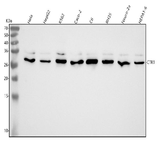 1 - Anti-CTR1/SLC31A1 Rabbit Monoclonal Antibody ABO16116