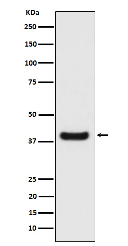 1 - Anti-Erlin-2 Rabbit Monoclonal Antibody ABO16117