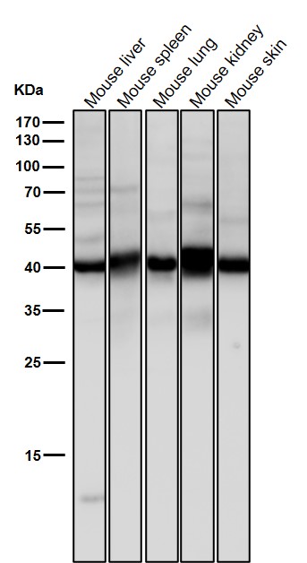 1 - Anti-Erlin-2 Rabbit Monoclonal Antibody ABO16117